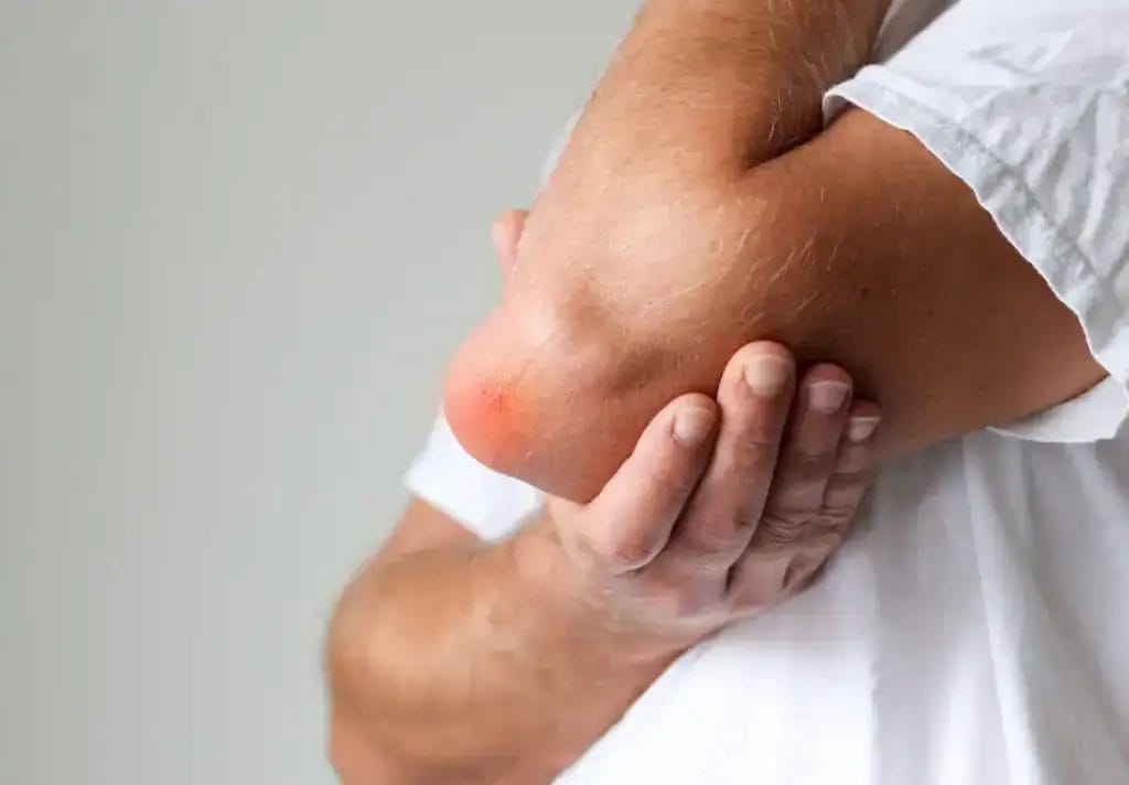 Achy elbow pain relief, orthopedic treatment, Dr. Burke Orthopedics, Houston, TX.